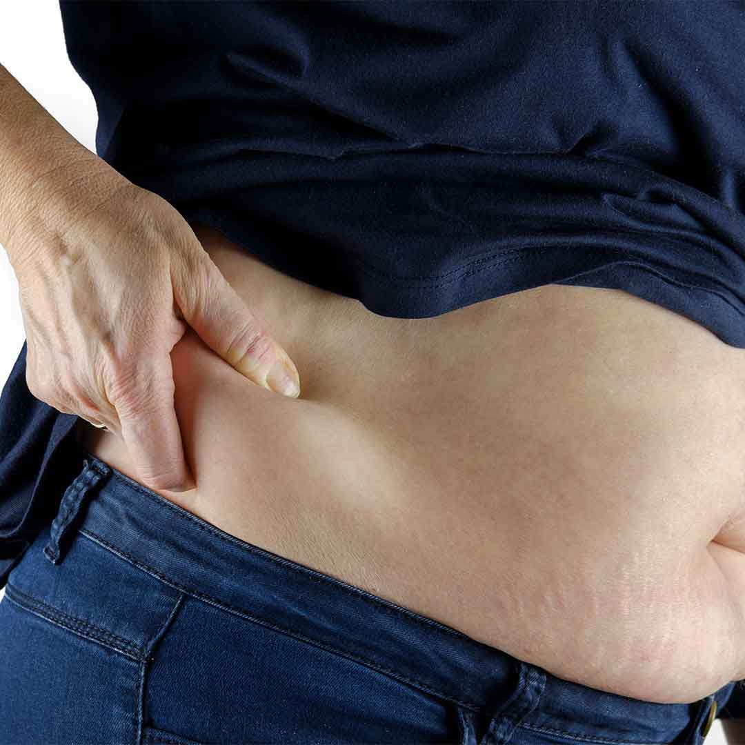 How to Lose Belly Fat in a Week Gharpar.co