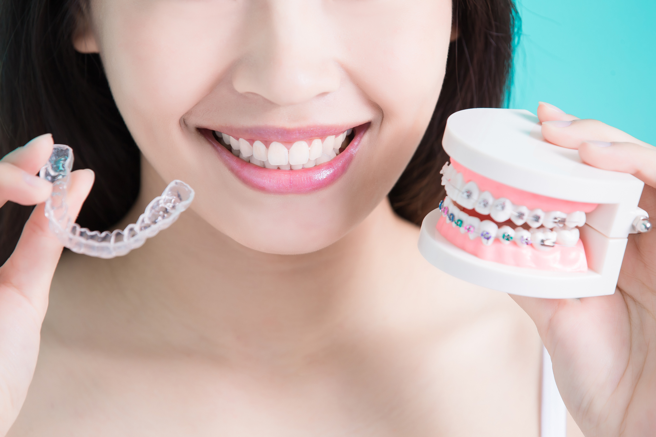 Get Invisalign or Damon Braces from Ghosh Orthodontics