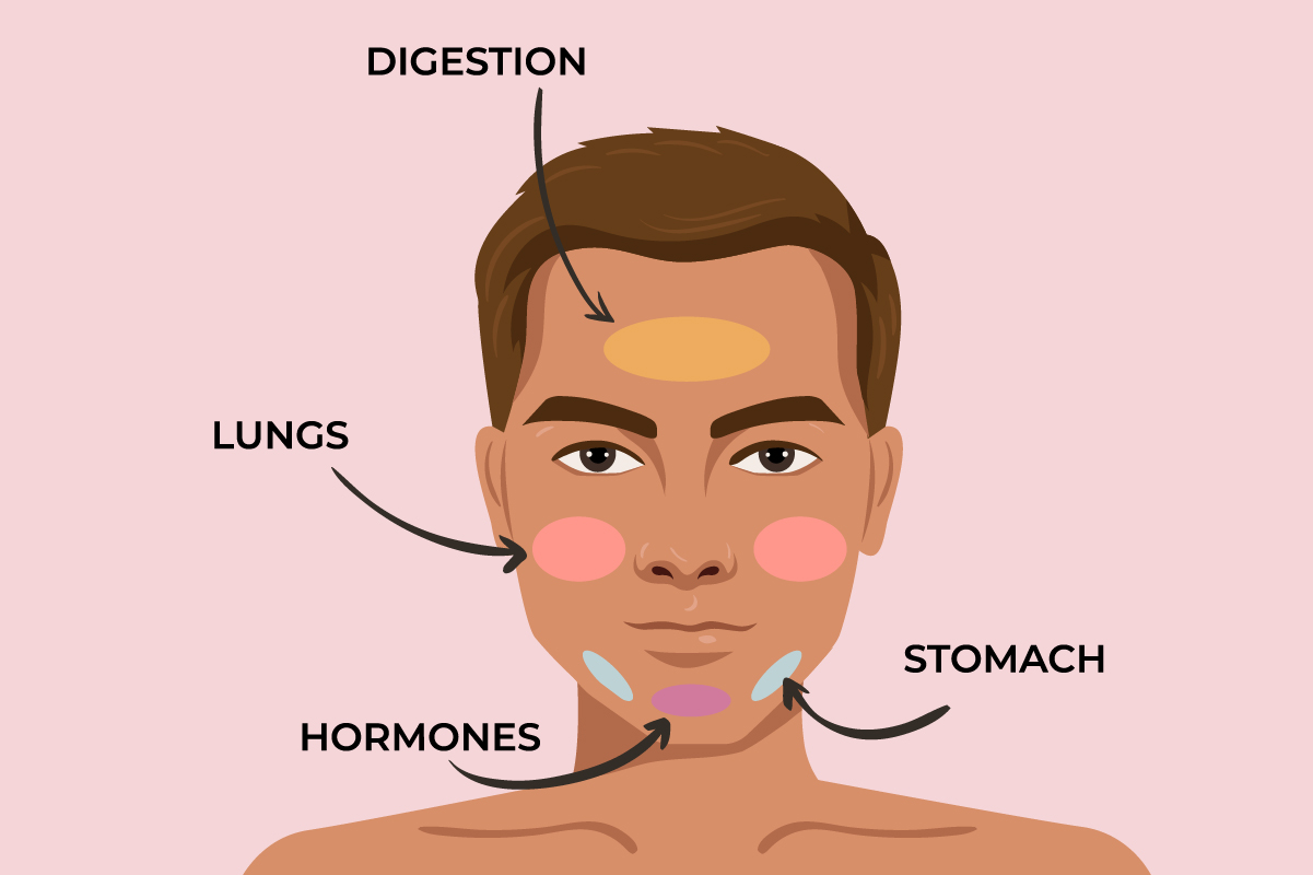 Can Dandruff Cause Acne?