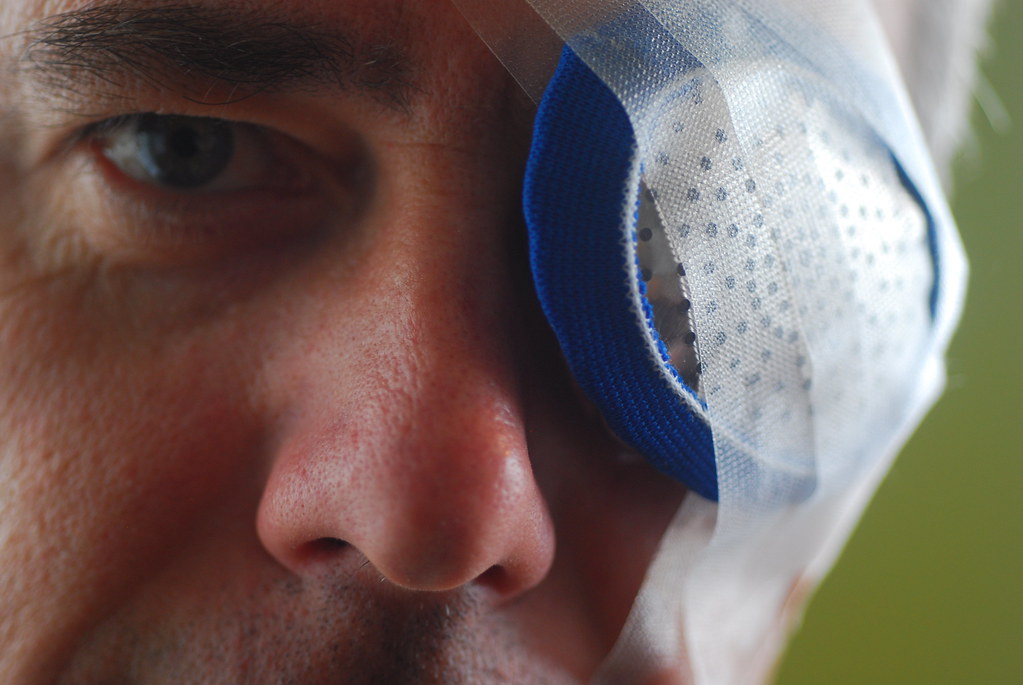 How To Wash Hair After Cataract Surgery?