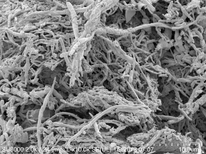 Why does my belly button smell? GirlWithAnswers