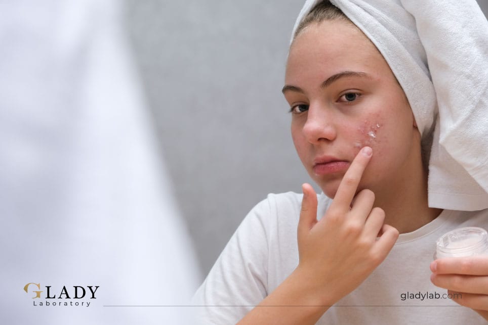 Keratosis pilaris GladyLab