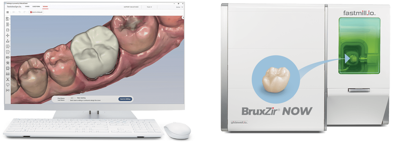 Glidewell.io SameVisit Dentistry CAD CAM System