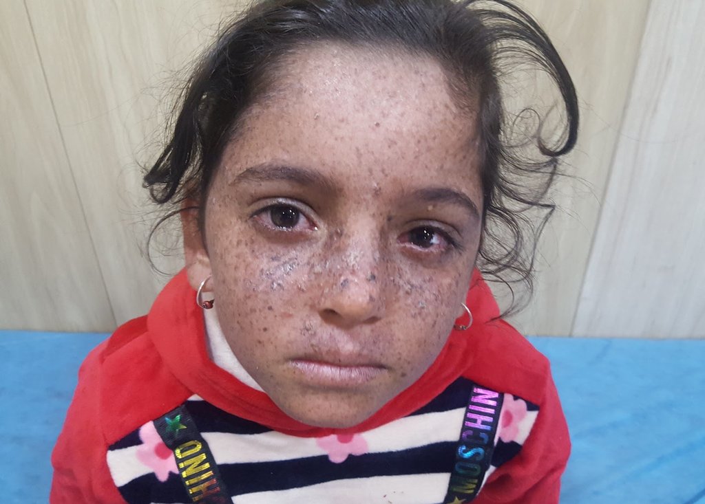 Global Skin Atlas Diagnosis Detail