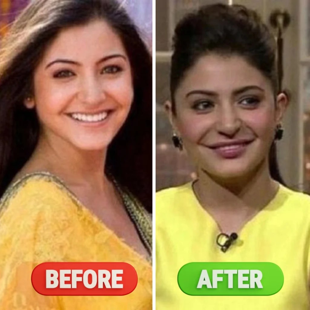Bad Surgery Celebrities 60 Photos Moonagedaydream.film