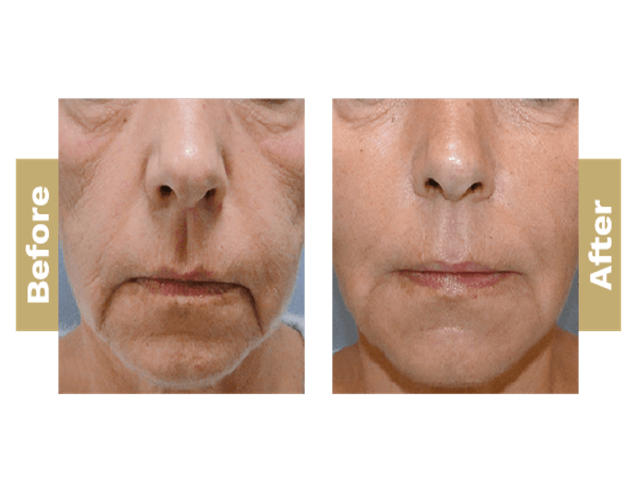 Home Gloss Hair, Beauty and Aesthetics Oxted