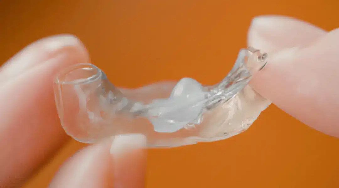 How To Remove Super Glue From Retainer? Tips and Tricks Gluedigi
