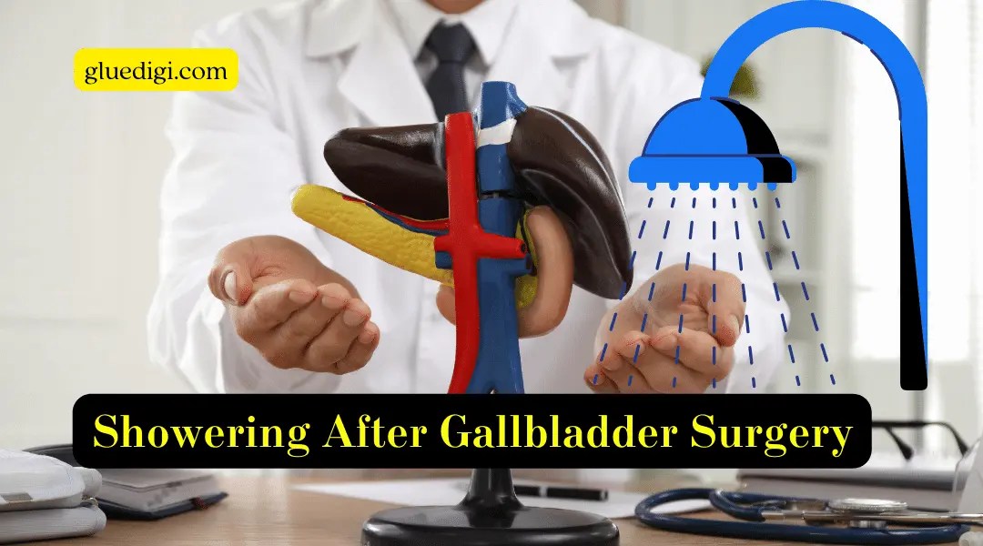 Showering After Gallbladder Surgery with Glue What You Need to Know