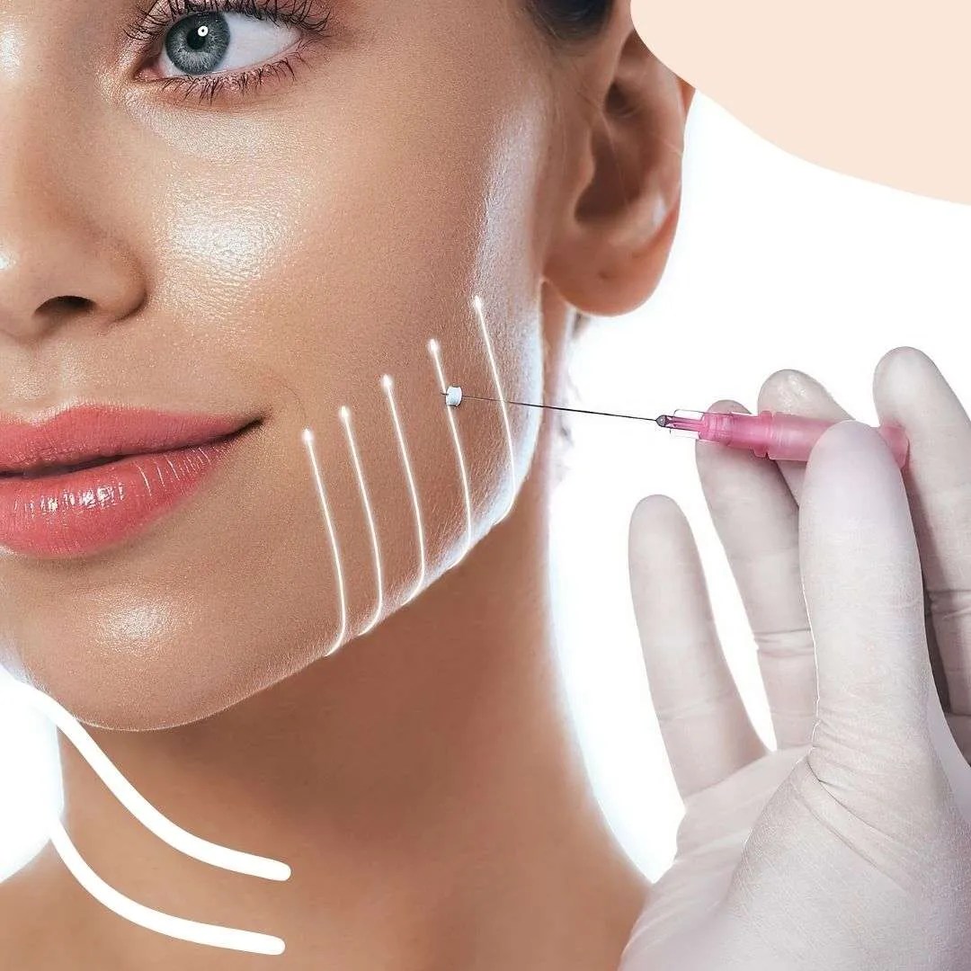 PDO Thread Lift, PDP Smooth Thread, Botox or Dermal Fillers? The