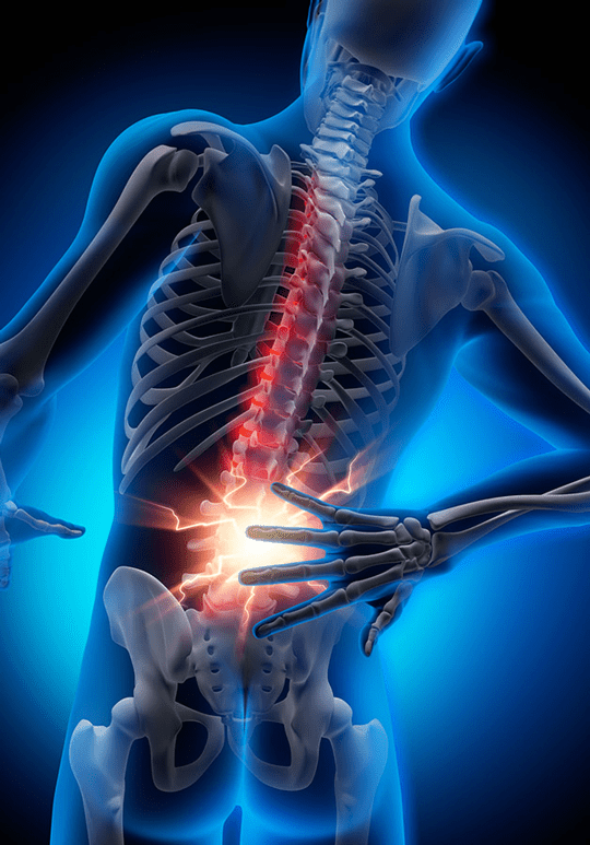 Back pain What does a slipped disc feel like? How do you