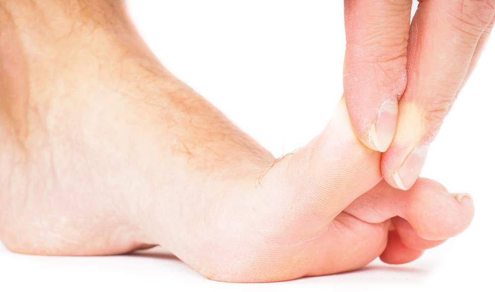 How To Ease Pain On Outside Of Foot With Home Remedies
