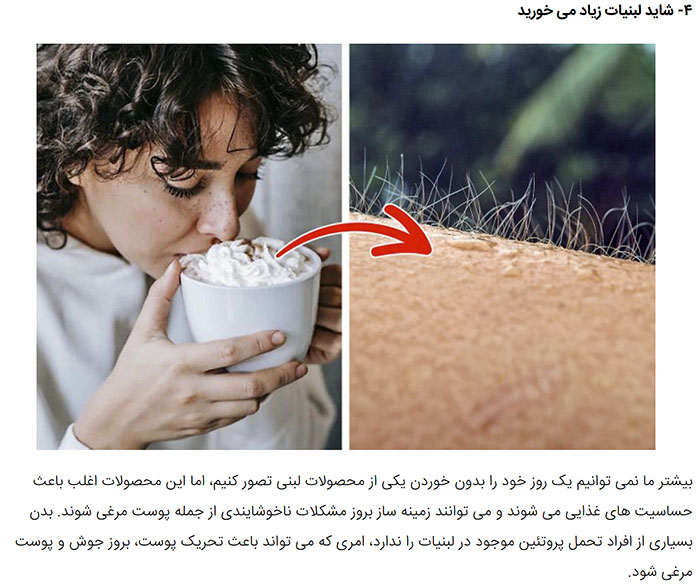 What Causes Chicken Skin, and Ways to Get Rid of It Goftar News