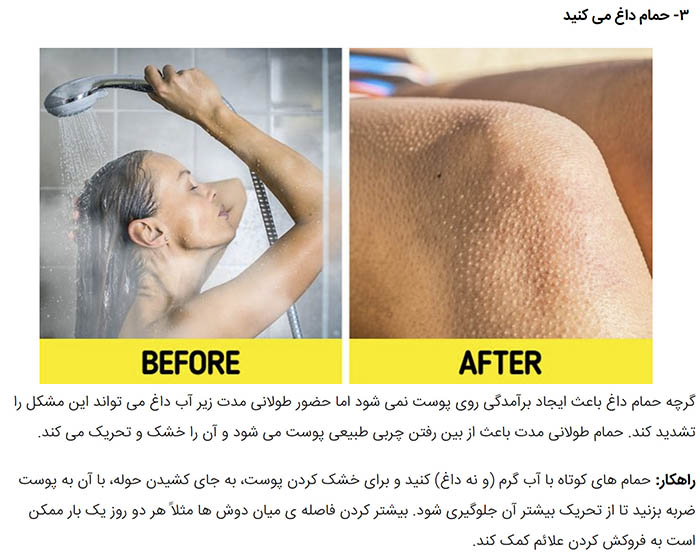 What Causes Chicken Skin, and Ways to Get Rid of It Goftar News