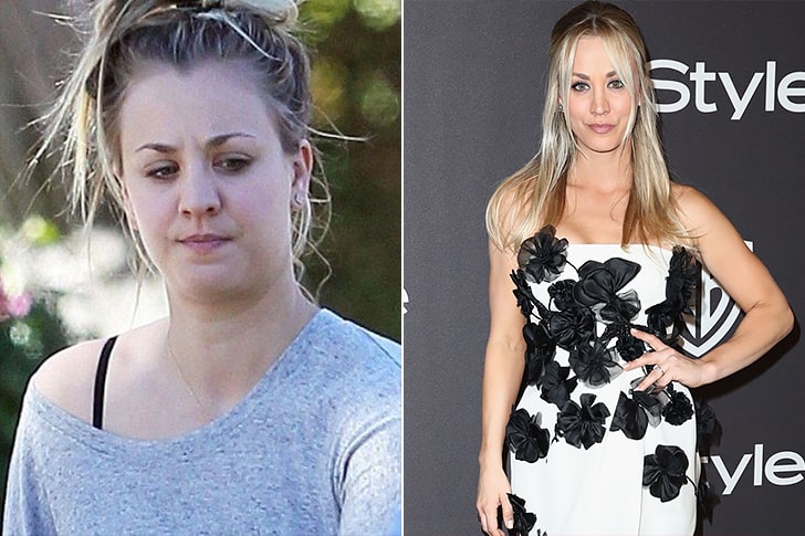 Famous Celebrities Lost So Much Weight See Who Did It Naturally & Who
