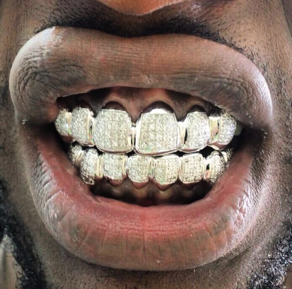 Custom Grillz Gold Grillz Diamond Grillz Custom Jewelry