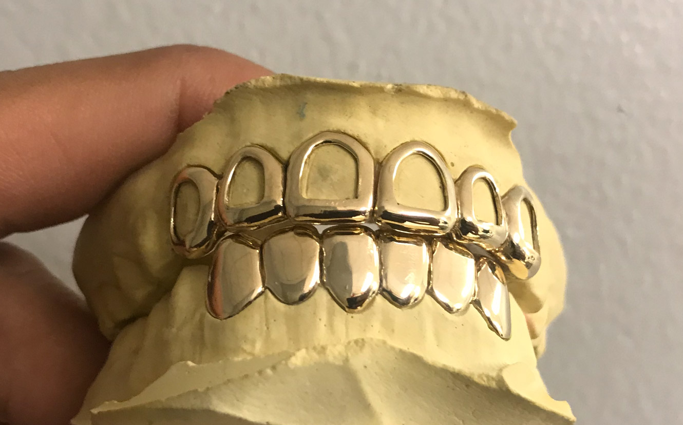 10K SOLID GOLD 6 TOP & 6 BOTTOM Gold Teeth Master