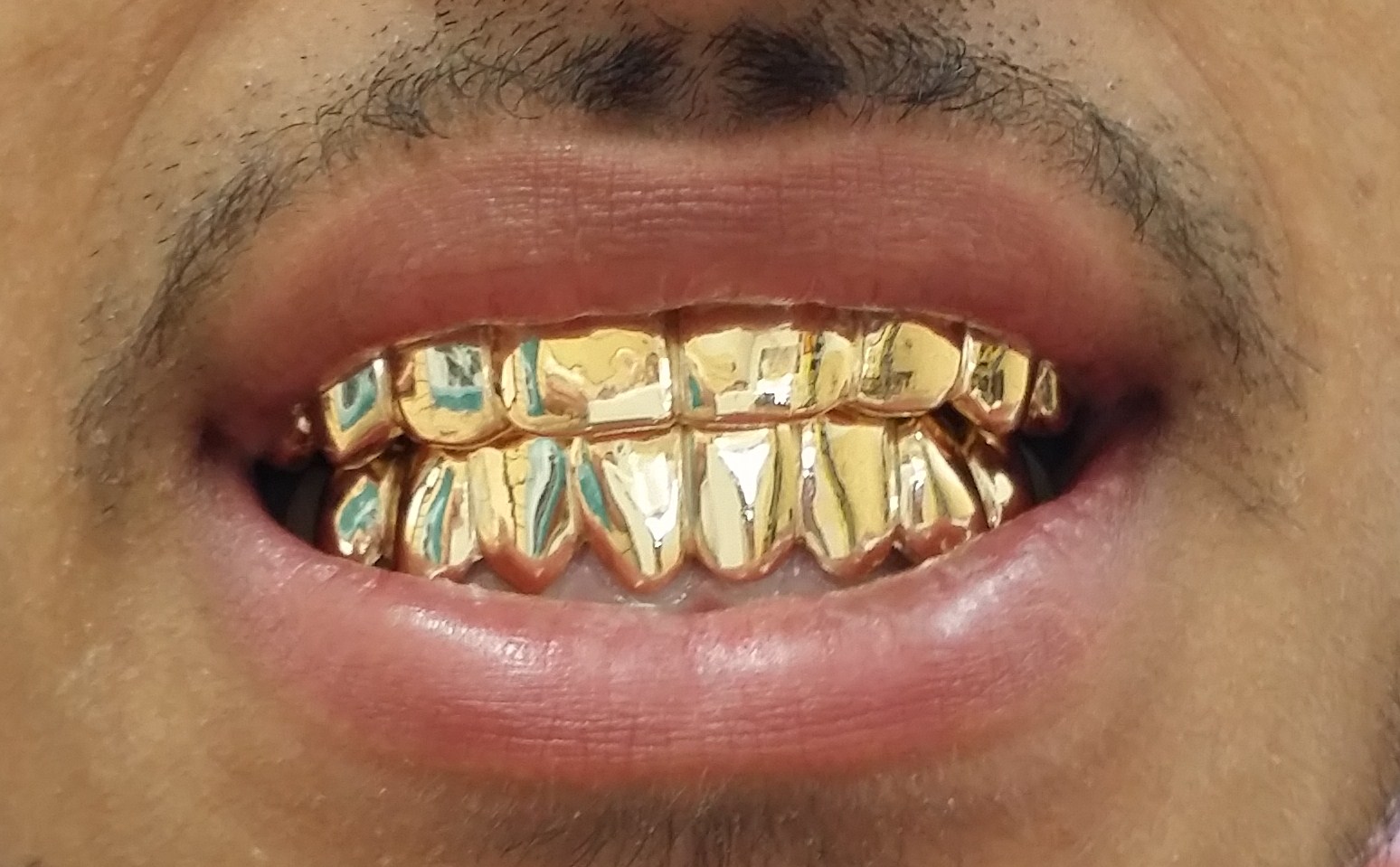 Gold Grillz Miami
