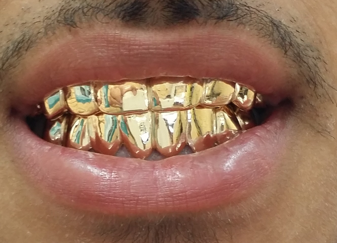 Gold Grillz Miami