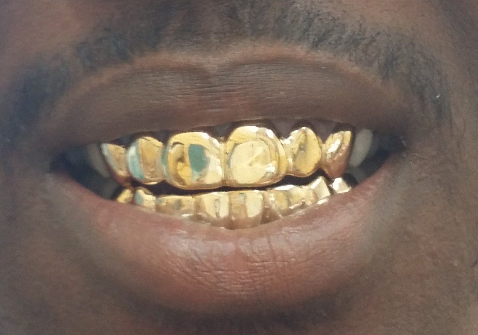 Gold Teeth Miami Pin on Gold Grillz Miami Bitcoin 2 Pizzas