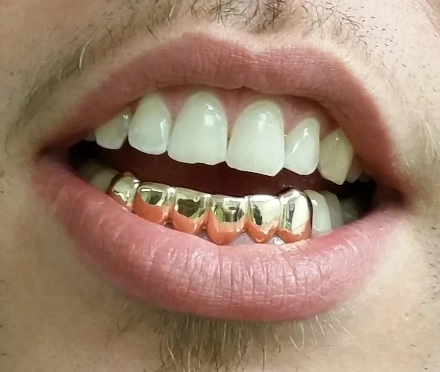 Gold Teeth Miami Pin on Gold Grillz Miami Bitcoin 2 Pizzas
