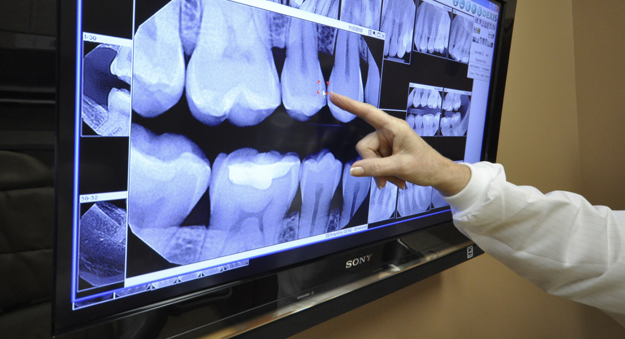 Radiografía dental en Madrid centro