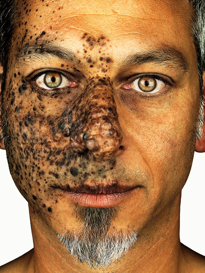 New Exhibition 'Love The Skin You Are In' Showcases People