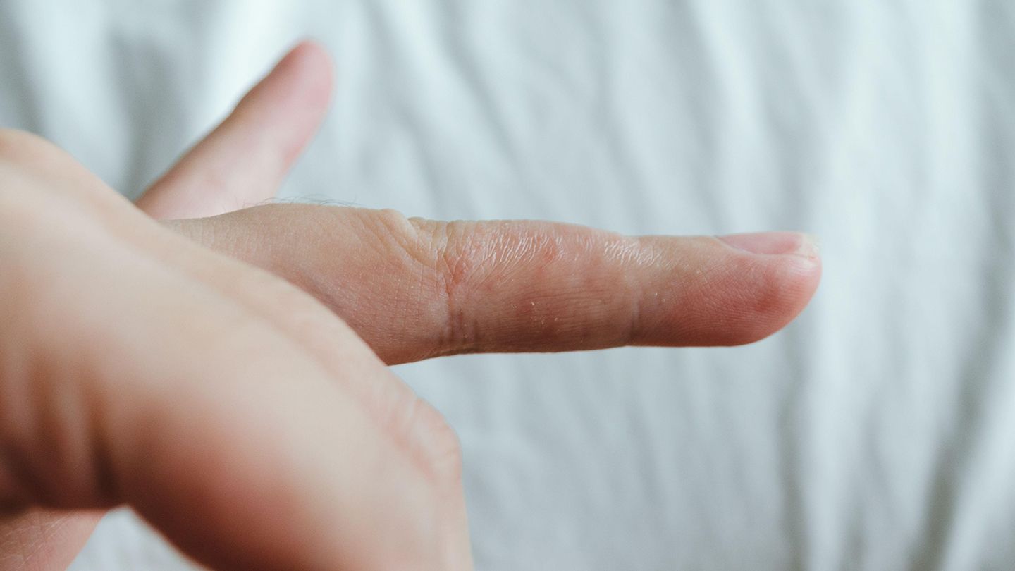 If you’ve once got tiny blisters on your fingers, you need to know this Goody Feed