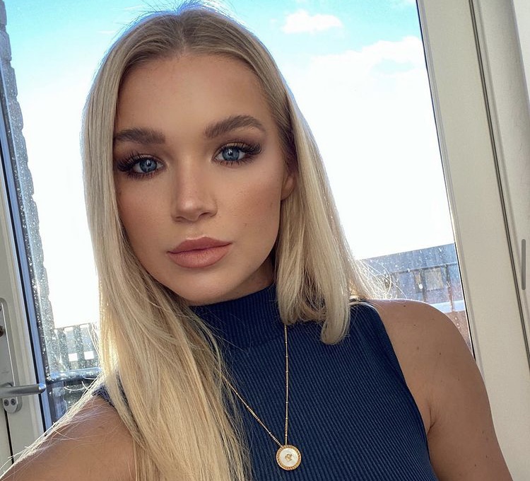 Abbie Quinnen shares snaps of her burnt skin after catching fire