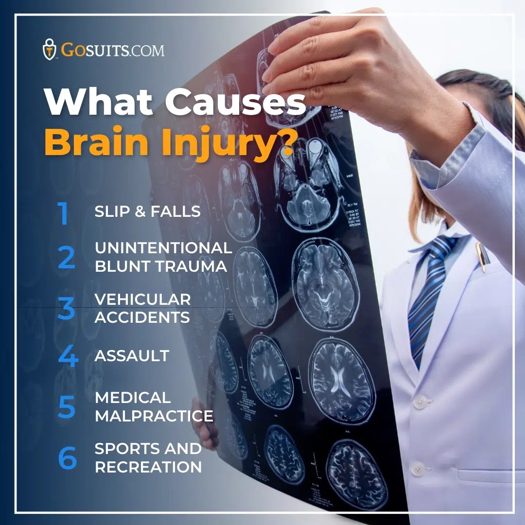Experienced Traumatic Brain Injury Lawyer