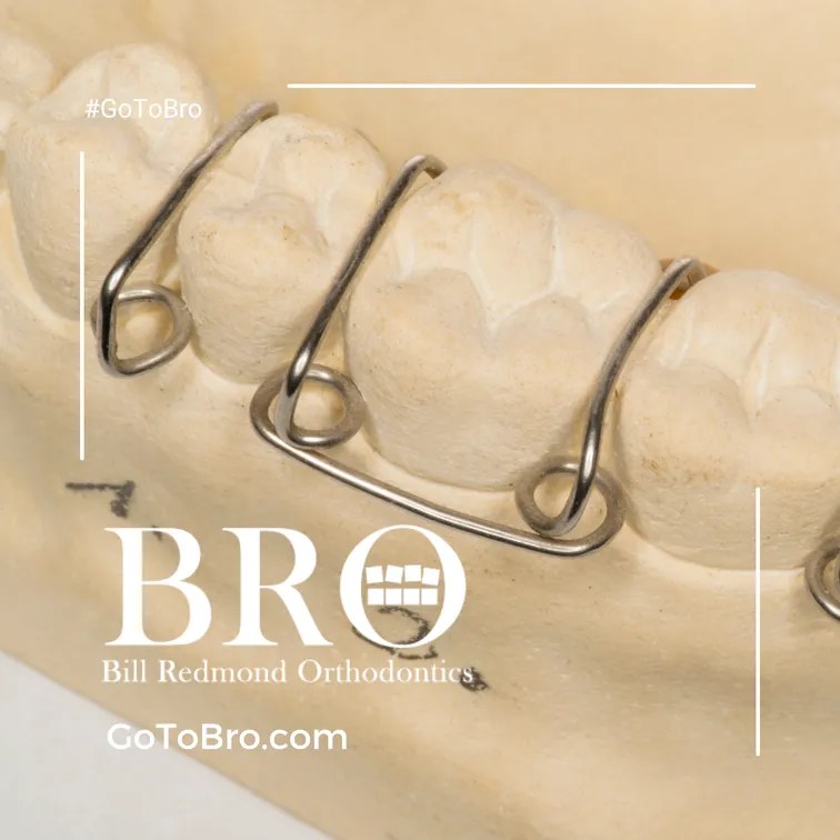 Can You Get Braces With Fillings? (Everything To Know) GoToBro