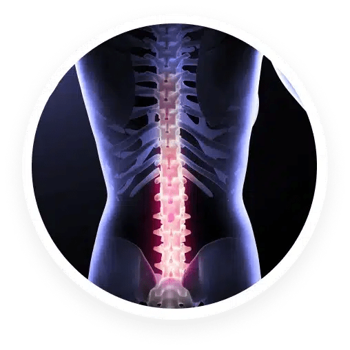 Facet Syndrome Choose AZ Pain and Spine Institute