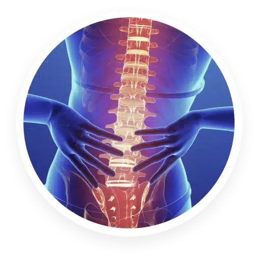Lumbar Epidural Steroid Injection Pain Management Doctors