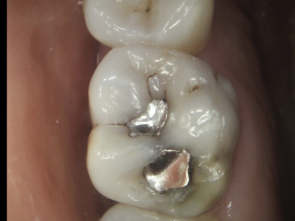 Before And After Spring Dental Group