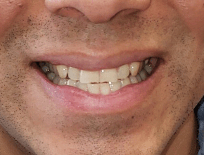 Smile Gallery College Family Dentistry Baton Rouge, LA