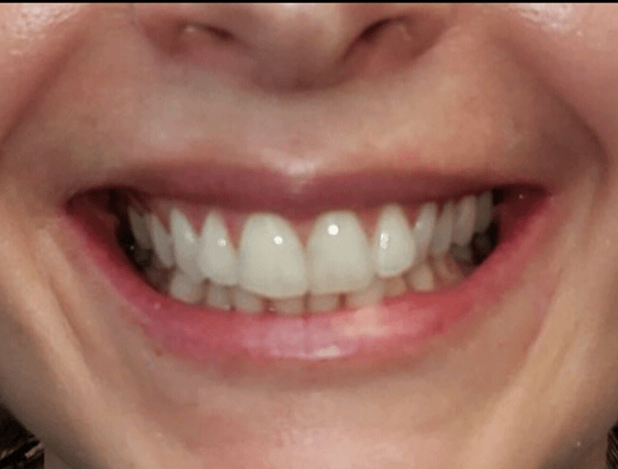 Smile Gallery College Family Dentistry Baton Rouge, LA