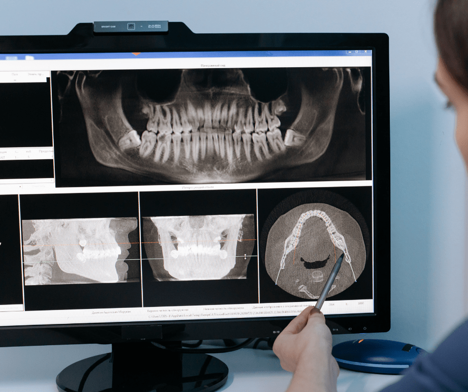 Are Dental Radiographs Necessary? Dr. Jennifer Nguyen Edmonton, AB
