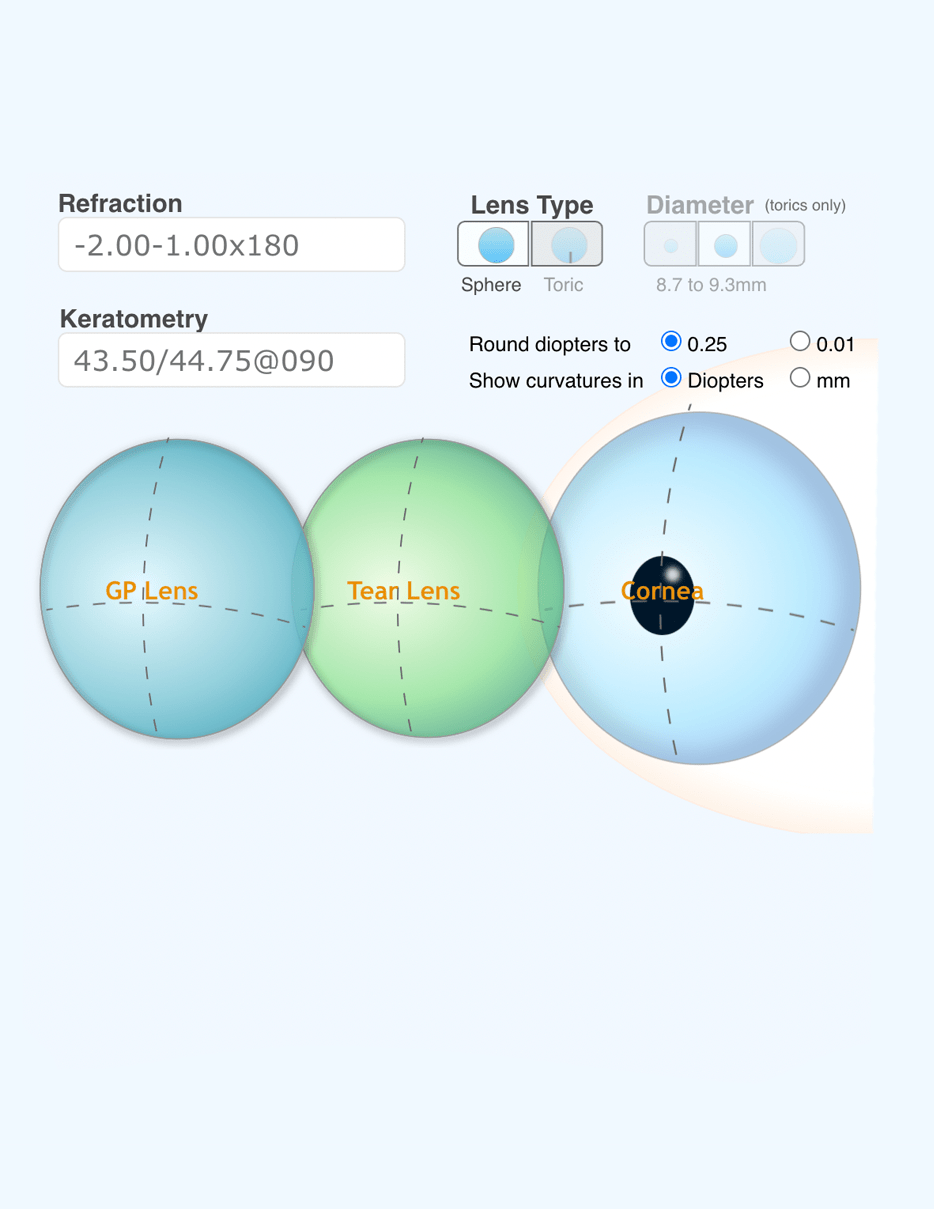 Bitoric / High Astigmatism Tools and Resources GPLI