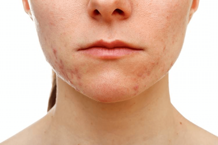 Three things that happen to your body when you don’t shower Grandma's