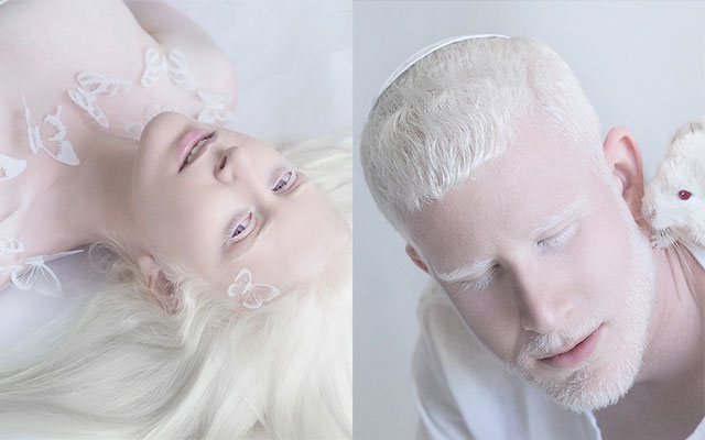 35 Cute Ideas | Portrete, Fotografie Artistică, Poze Majorat アルビノの人をうつした写真 白の世界が美しい – Grape [グレイプ]