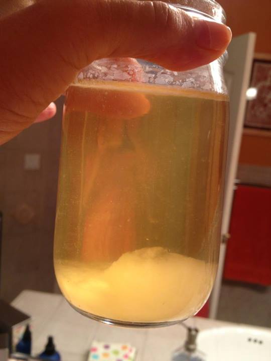 Urine Sediment (w/ Pictures) GrapeGate