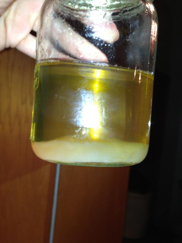 Urine Sediment (w/ Pictures) GrapeGate