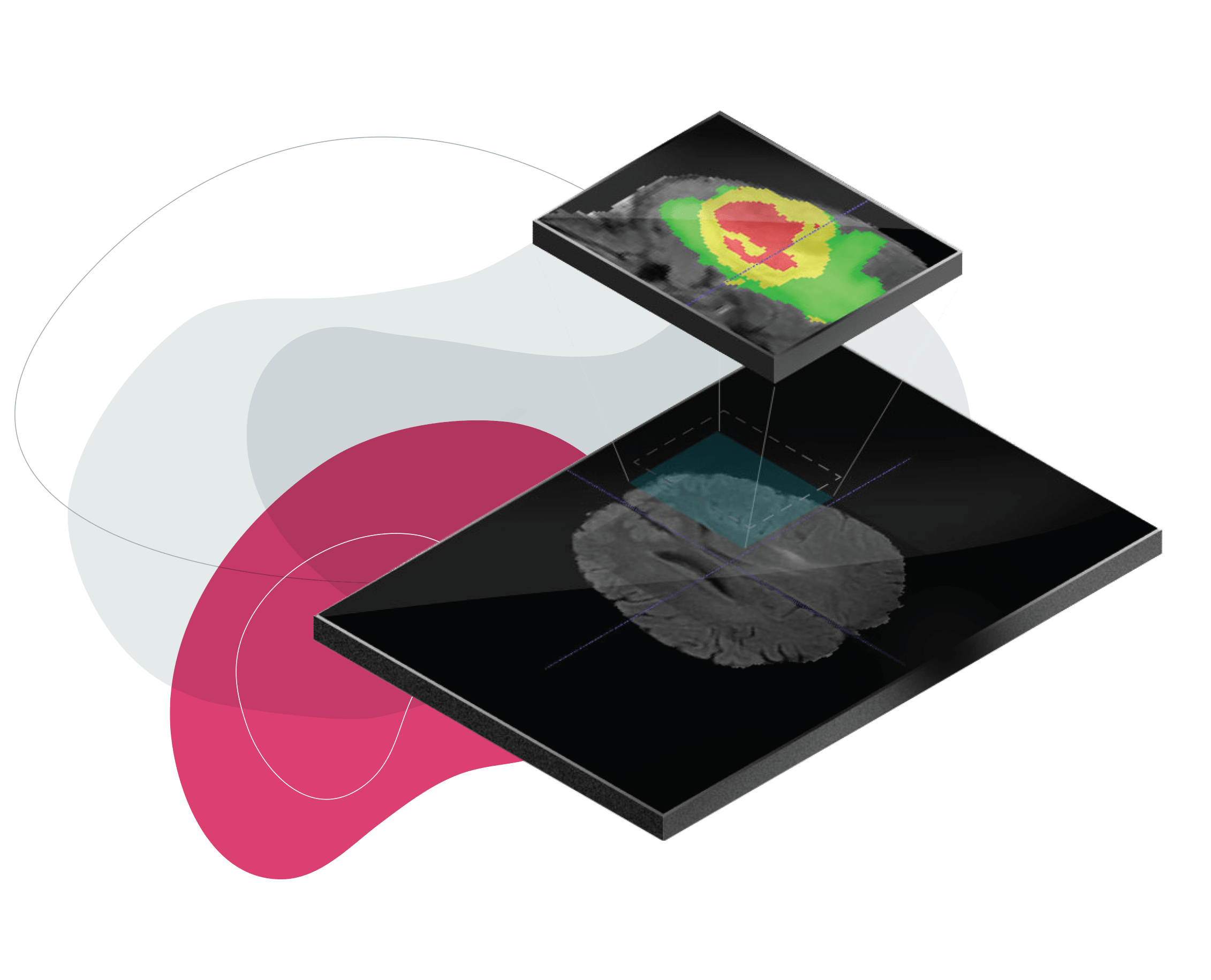 Medical image analysis Graylight Imaging