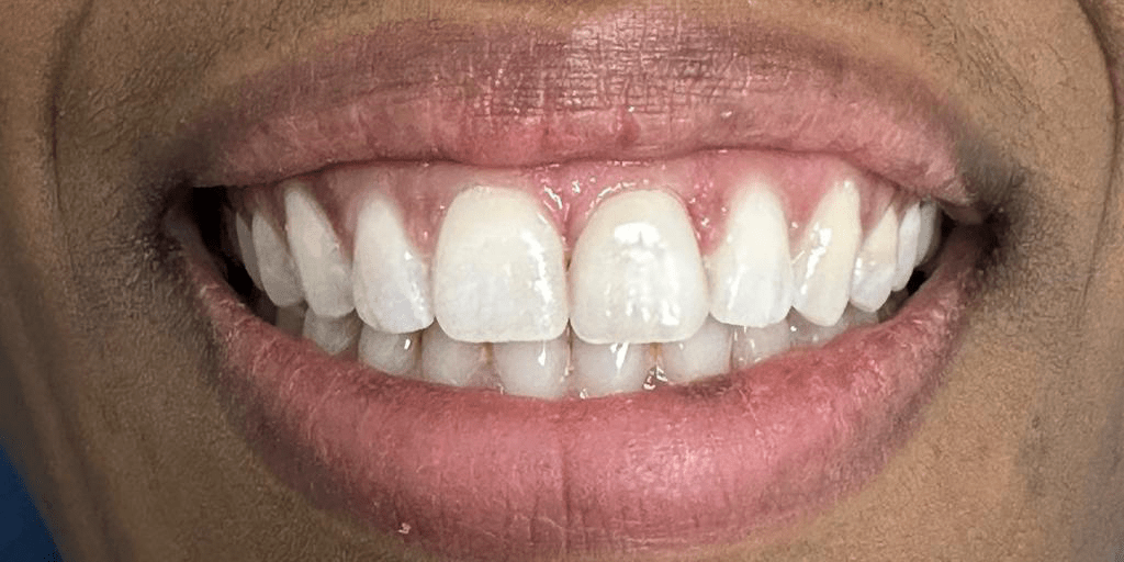 Smile Gallery Greenpoint Dental