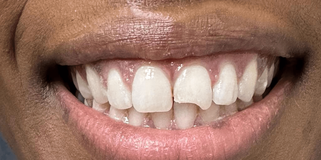 Smile Gallery Greenpoint Dental