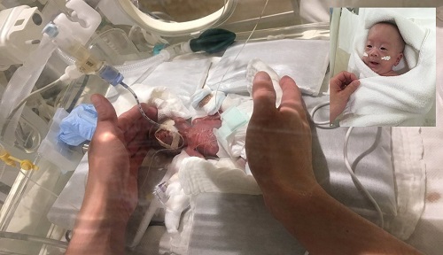 En Tokio Nacio El Bebe Mas Pequeno Del Mundo Peso 268 Gramos El Grillo