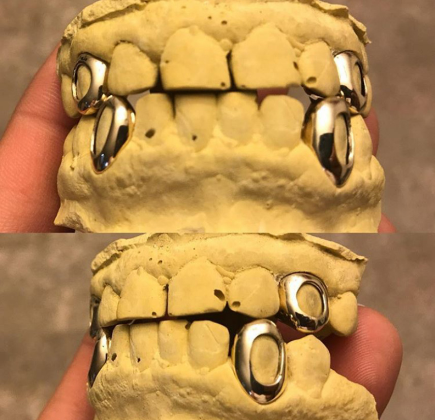 10K Solid Gold Top & Bottom Fangs Grillz Pro