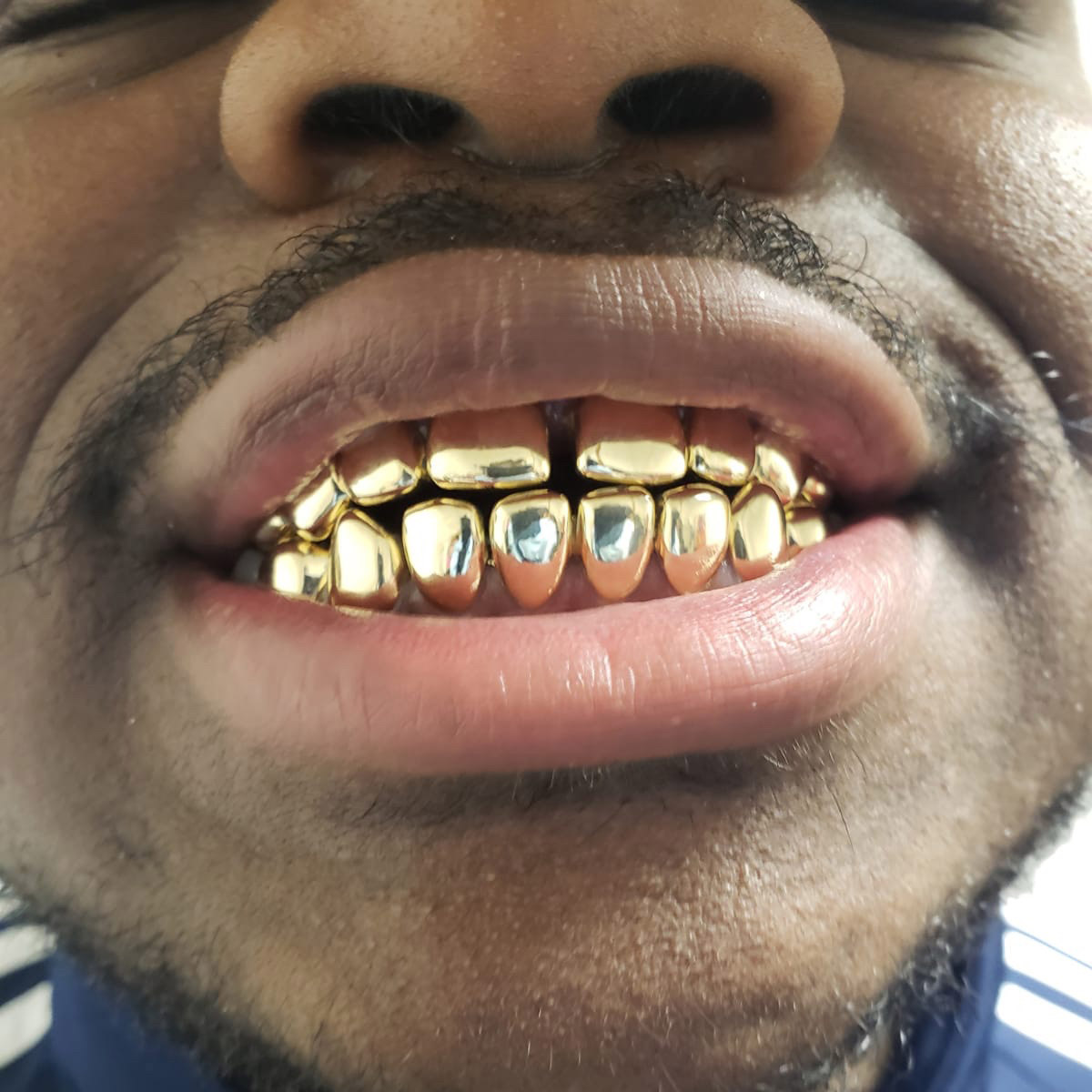 10K Solid Gold 8 Top & 8 Bottom Grillz Pro