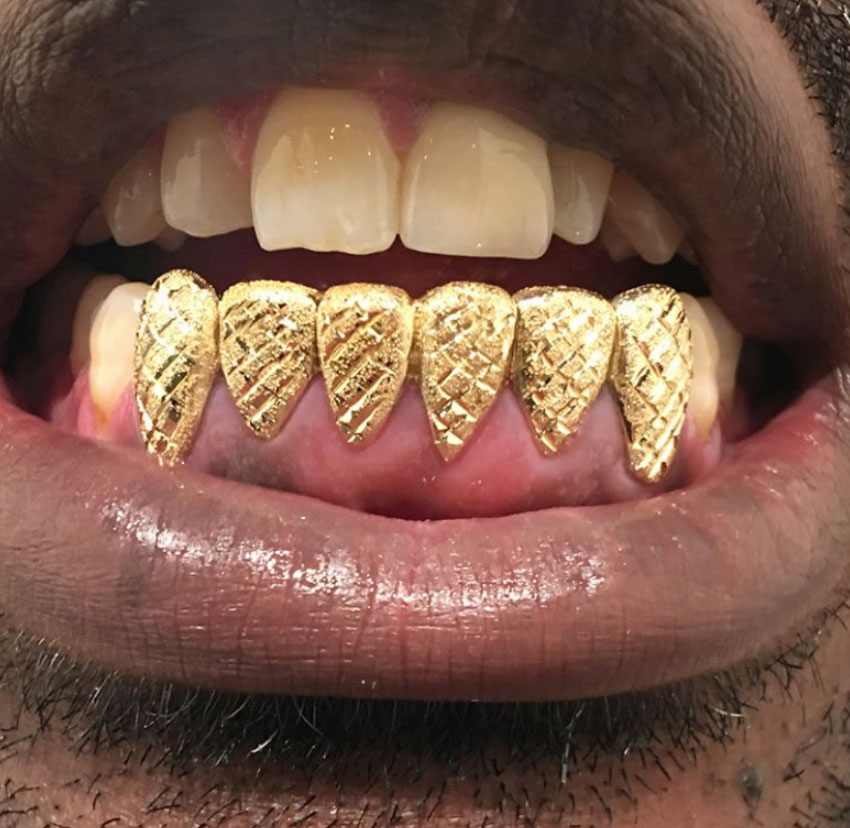 10K Solid Gold 6 Top or 6 Bottom Grillz Pro
