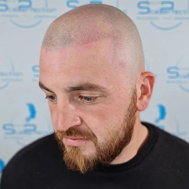 Buzz Cut Lengths Breakdown Number 0 To 8 Dashing Concepts For Modish Men