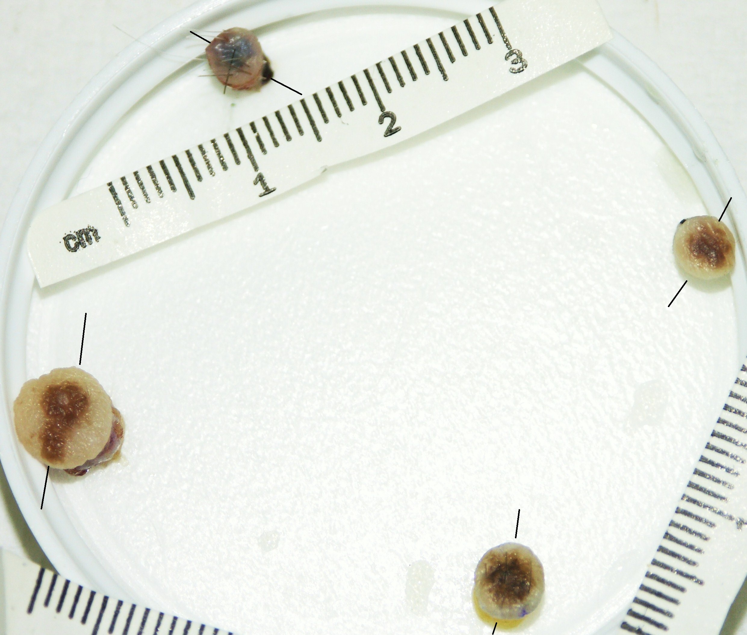 Punch biopsy Archives GROSSING TECHNOLOGY in SURGICAL PATHOLOGY